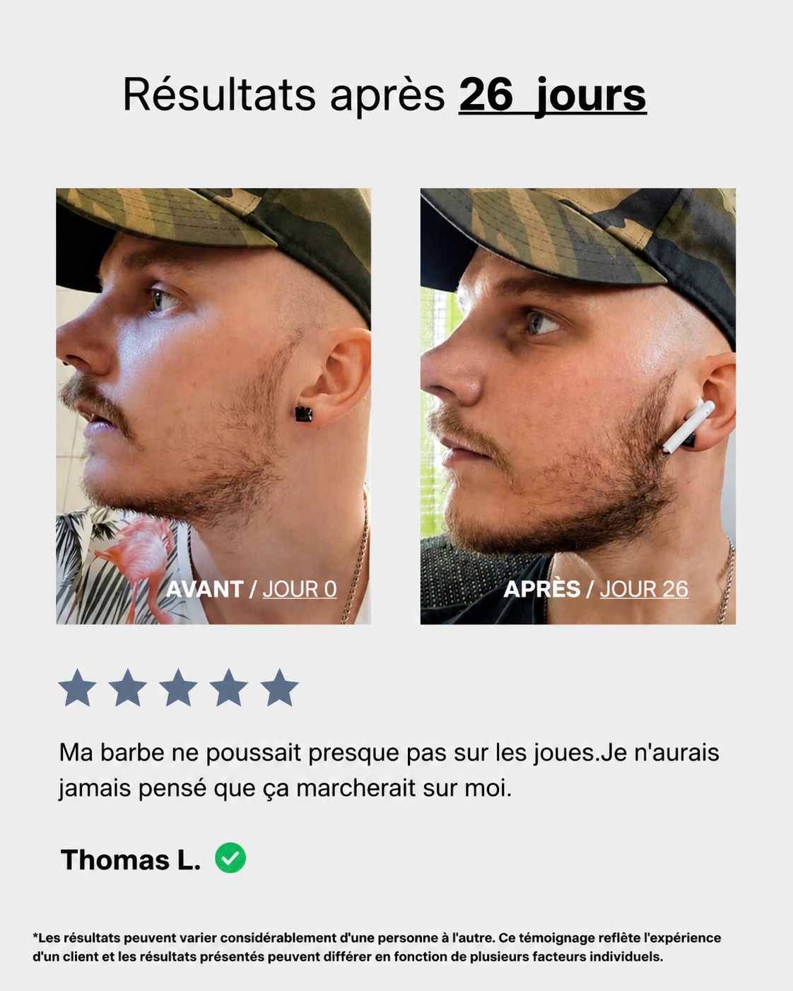 Sérum roll on ( sur place )